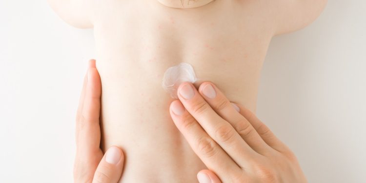 香料成分是否會對寶寶肌膚造成刺激？醫揭真相停看聽