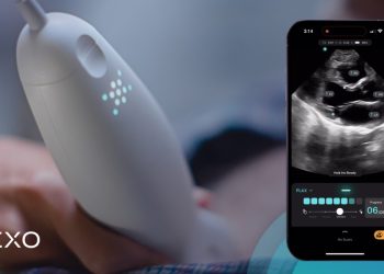 三星創投擬參與Exo新一輪募資 AI掌上超音波裝置引發關注