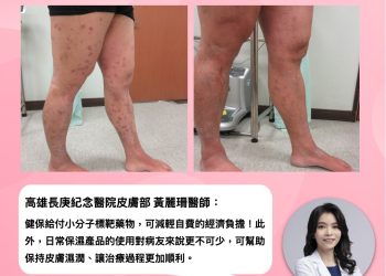 異位性皮膚炎癢到徹夜難眠？靠健保給付小分子標靶藥物找回生活節奏