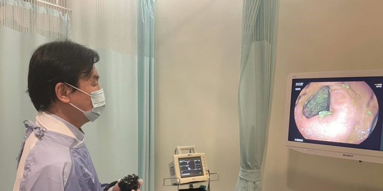 AI輔助大腸鏡提升早期癌篩精準度