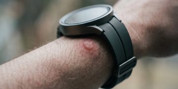 三星 Galaxy Watch 5 Pro 過熱致手腕水泡，專家籲睡前6項檢查